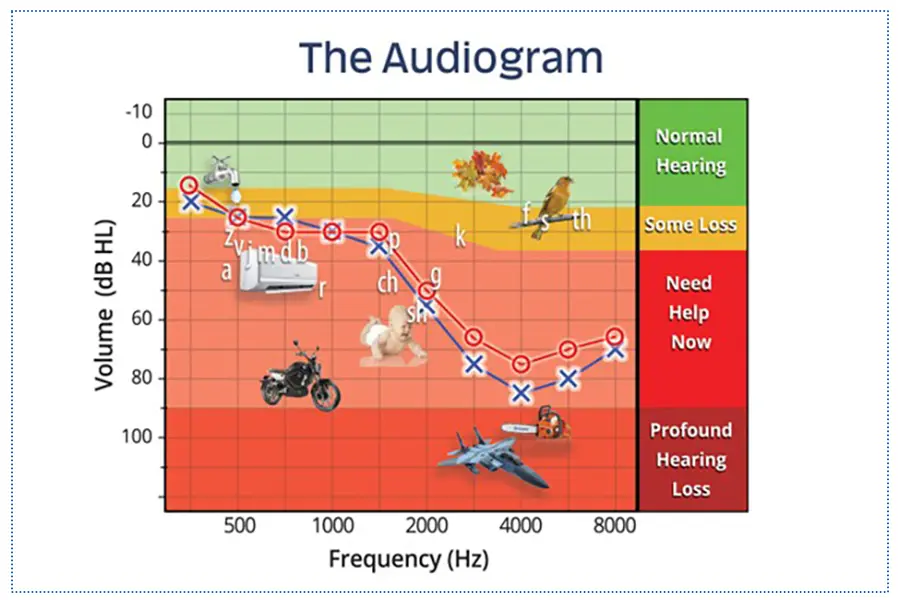 İşitme Kaybı ve İşitme Cihazları - Prof. Dr. Şenol Polat Basics of the Audiogram