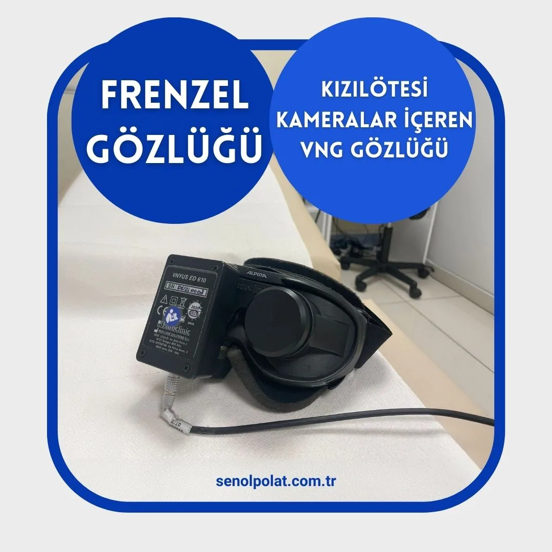Videonistagmografi (VNG) Testi ile Vertigo Teşhisi - Prof. Dr. Şenol Polat frenzel gözlüğü - kızılötesi kameralar içeren VNG gözlüğü